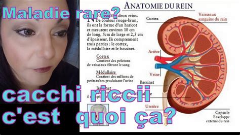 cacchi ricci